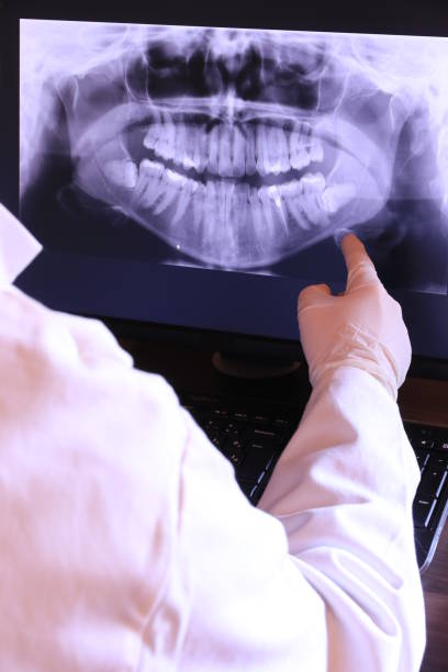 Best Emergency Broken Tooth Repair in New Port Richey, FL